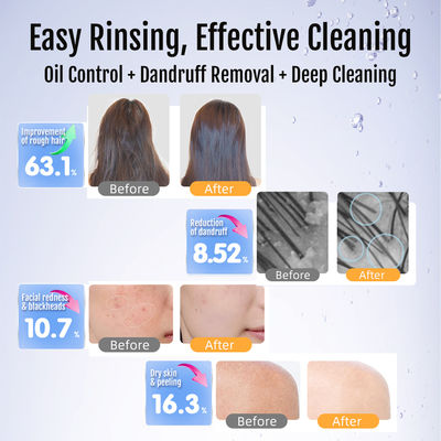 Máy tạo bọt bằng đồng thau & thép không gỉ cao cấp | Thanh lọc vòi sen siêu mịn